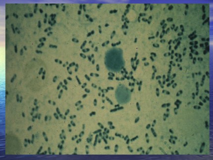 鼠疫Plague鼠疫耶尔森菌yersiniapestis自然疫源疾病第7页