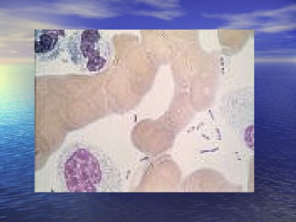 鼠疫Plague鼠疫耶尔森菌yersiniapestis自然疫源疾病第8页